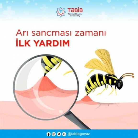 Arı sancması zamanı ilk yardım tez edilərsə, ağrı daha az, sağalma isə daha sürətli olar