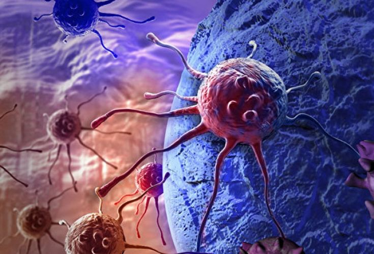 Xərçəng xəstəliyi şişlərinin məhvi üçün radioaktiv gel hazırlanıb
