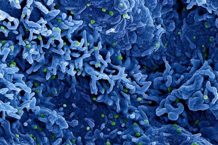 ÜST meymunçiçəyi virusu ilə bağlı beynəlxalq səviyyədə fövqəladə vəziyyət statusunu dəyişməyib