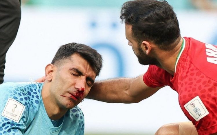 DÇ-2022: İran millisi ciddi itki ilə üzləşib<font color=red> - VİDEO</font>