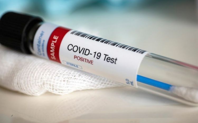 Dünyada COVID-19-a yoluxanların sayı 656,9 milyonu ötüb