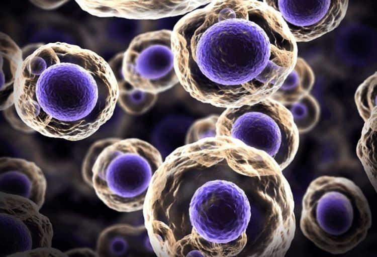 Xərçəng xəstəliyinin müalicəsində kök hüceyrələri texnologiyalarının böyük rolu olacaq