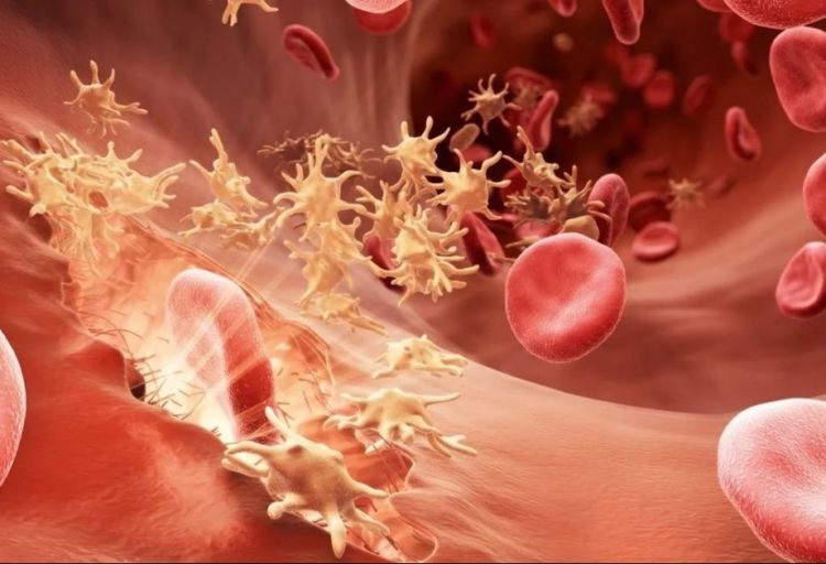 Aprelin 17-si Ümumdünya Hemofiliya Günüdür