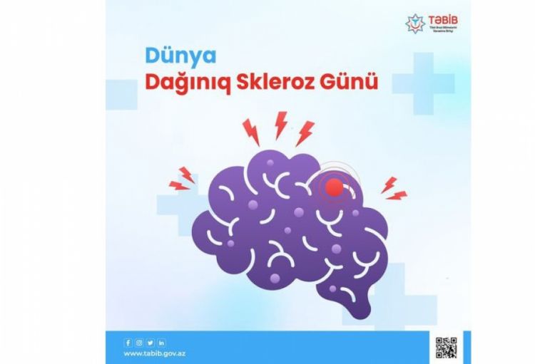Nevroloq: Dağınıq sklerozun müalicəsində ilk növbədə kəskin epizodların qarşısı alınır