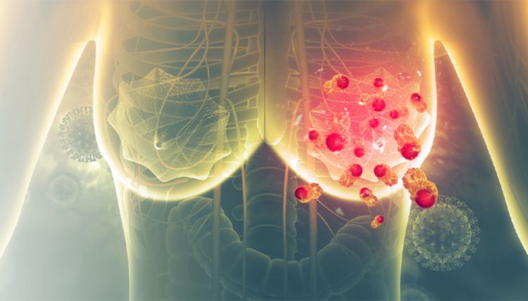 Alimlər döş xərçəngi ilə mübarizədə yeni kəşfə imza atıblar