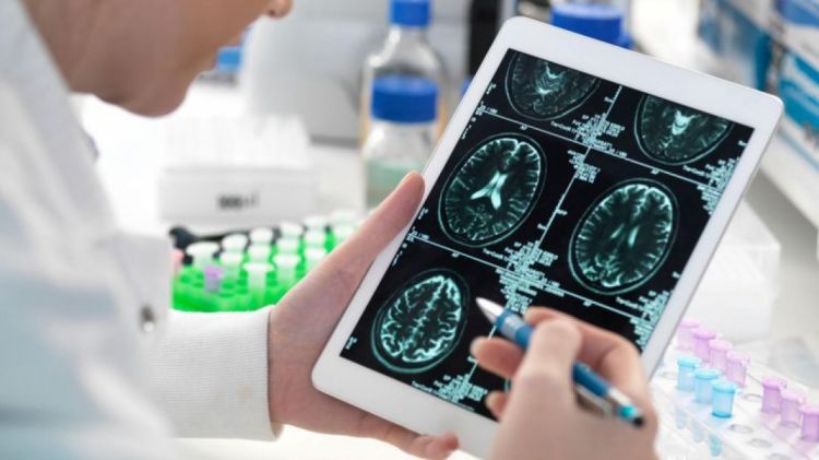Alimlər Alzheimer xəstələrində beyin hüceyrələrinin hansı səbəbdən öldüyünü aşkar ediblər