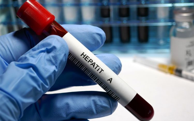 Səhiyyə Nazirliyi Hepatit A infeksiyasına yoluxma halları ilə bağlı məlumat yayıb