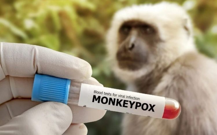 Meymunçiçəyi xəstəliyi ilə mübarizə üçün 3,6 milyon dozadan çox peyvənd ayrılıb