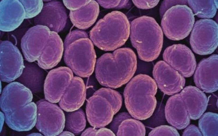 Alimlər antibiotiklərin bakteriyaları öldürən yeni formasını icad ediblər