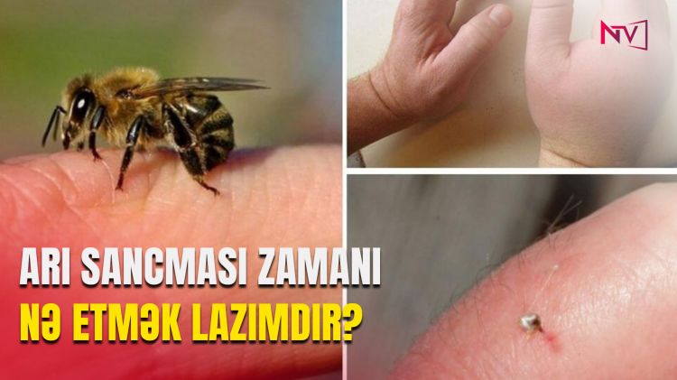 Arı sancması zamanı nə etmək lazımdır?<font color=red> - VİDEO</font>