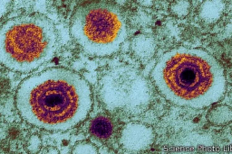 Alimlər yeni təhlükəli virus aşkarlayıblar