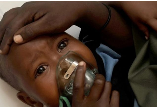 Nigeriyada "Lassa" qızdırmasından 162 nəfər ölüb