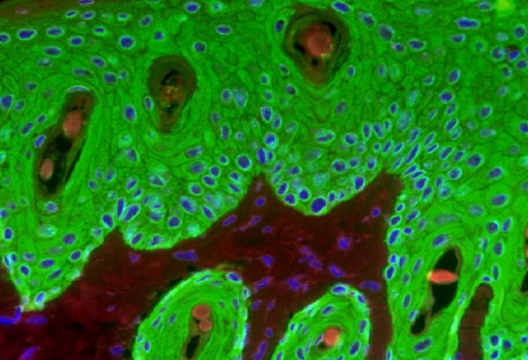 Yaponiya alimləri unikal təbii dəri transplantı hazırlayıblar