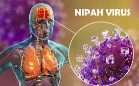 Aİ Hindistanda aşkarlanan Nipah virusu ilə bağlı vəziyyəti izləyir