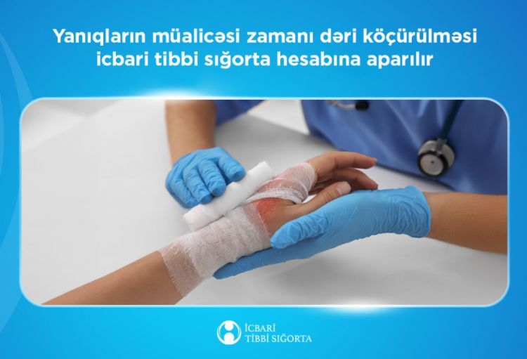 Yanıqların müalicəsi zamanı dəri köçürülməsi icbari tibbi sığorta hesabına aparılır