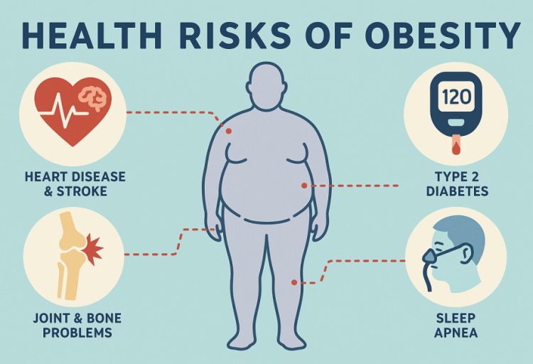 Tədqiqat: İnfeksion xəstəliklərdən ölüm hallarının 10 faizi piylənmə ilə bağlıdır