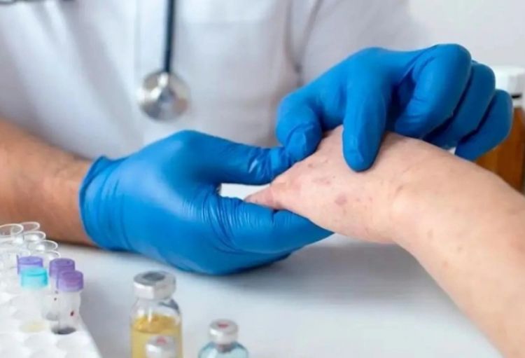 Almatıda qızılcaya yoluxma halları artıb