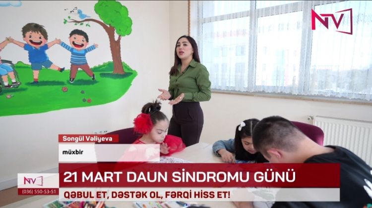 Fərqli olmaq zəiflik deyil – bu, sadəcə başqa cür gözəllikdir<font color=red> - VİDEO</font>