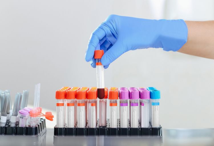 Bir damla qanla xərçəngin diaqnostikası üçün test hazırlanıb