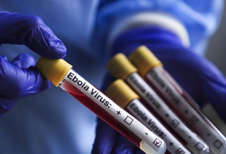 ÜST: Konqo DR-də “Ebola” virusu ilə bağlı vəziyyət ağırlaşır