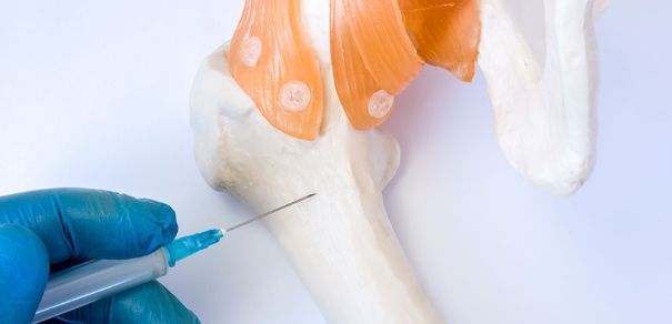 İcbari tibbi sığorta hesabına sümük iliyi transplantasiyasının illik limiti artırılıb