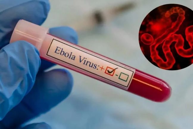 ÜST Ebolanın yeni ştammına qarşı peyvəndin hazırlanmasını sürətləndirir